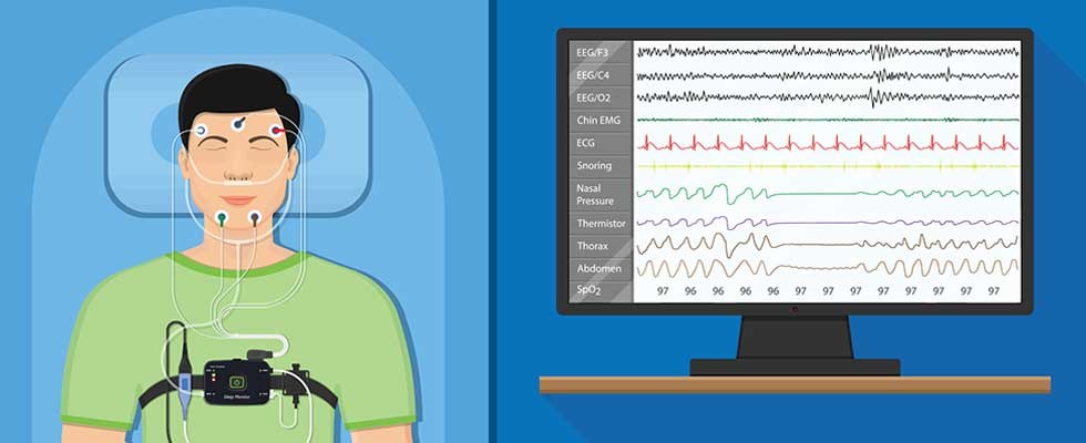 polysomnography