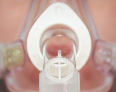 A CPAP mask on a woman's face